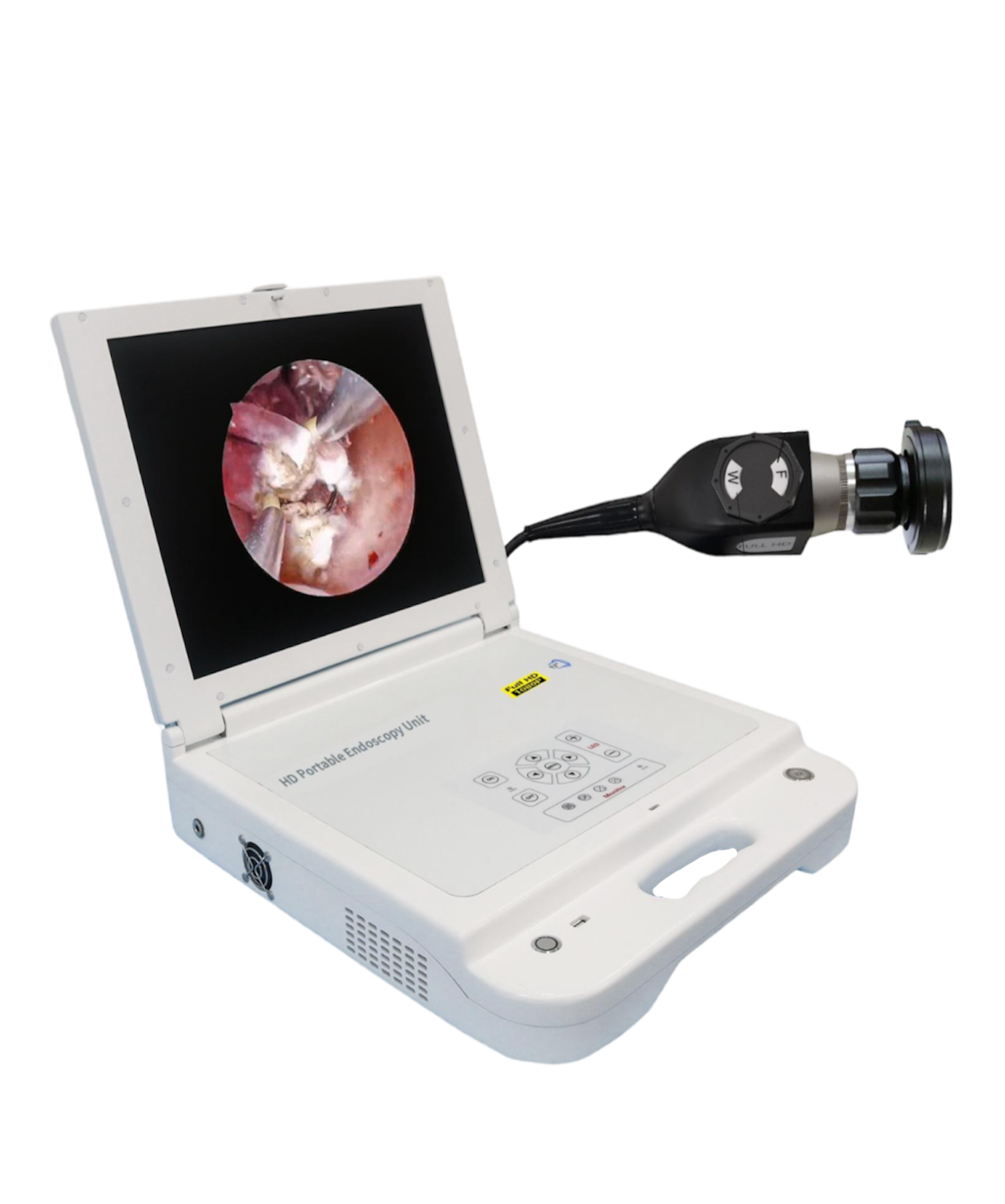 Portable HD Hystroscope